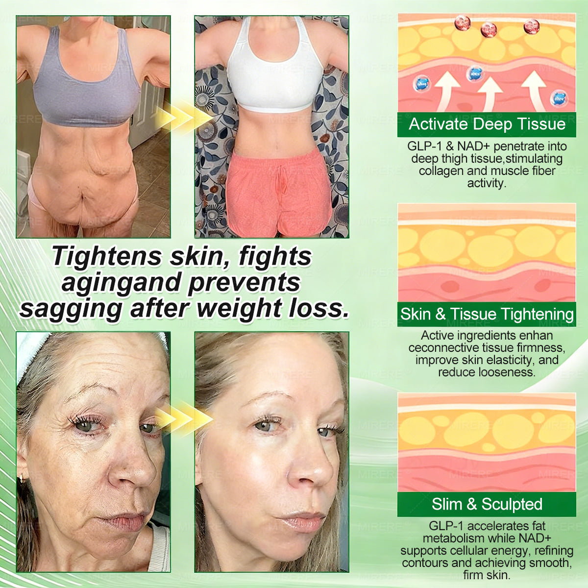 𝐌𝕀𝗥𝑬𝓡𝐄®  𝐍𝐀𝐃+ 𝐆𝐋𝐏-𝟏 Pro ALL-IN-ONE Fit&Vital 𝐎𝐫𝐚𝐥 𝐋𝐢𝐪𝐮𝐢𝐝 (𝐉𝐮𝐬𝐭 𝐨𝐧𝐜𝐞 𝐚 𝐝𝐚𝐲, 𝐯𝐢𝐬𝐢𝐛𝐥𝐞 𝐜𝐡𝐚𝐧𝐠𝐞𝐬 𝐢𝐧 𝟕 𝐝𝐚𝐲𝐬） ✅ 𝐅𝐨𝐫 𝐨𝐛𝐞𝐬𝐢𝐭𝐲, 𝐜𝐚𝐫𝐝𝐢𝐨𝐯𝐚𝐬𝐜𝐮𝐥𝐚𝐫 𝐡𝐞𝐚𝐥𝐭𝐡, 𝐝𝐢𝐚𝐛𝐞𝐭𝐞𝐬, 𝐬𝐥𝐞𝐞𝐩 𝐚𝐩𝐧𝐞𝐚, 𝐆𝐮𝐭 𝐇𝐞𝐚𝐥𝐭𝐡, 𝐣𝐨𝐢𝐧𝐭 𝐢𝐬𝐬𝐮𝐞𝐬, 𝐚𝐧𝐝 𝐦𝐨𝐫𝐞